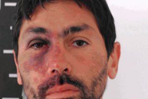 Tiene antecedentes penales, robó, hirió a un policía y cumplirá arresto domiciliario